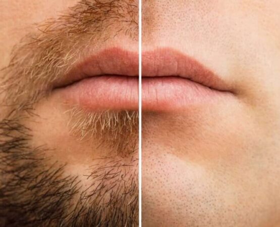 Dejarte crecer la barba