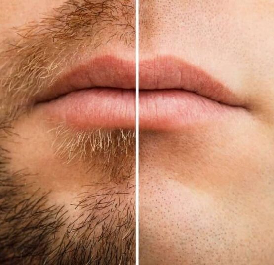 Dejarte crecer la barba