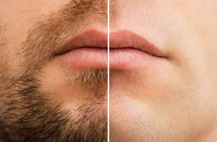 Dejarte crecer la barba