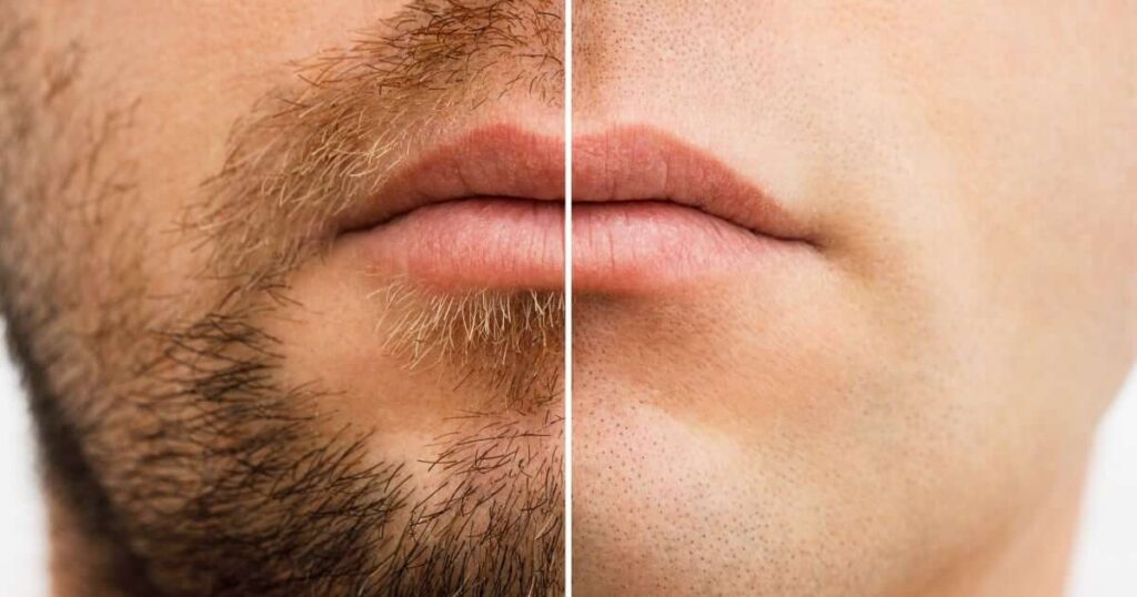 Dejarte crecer la barba